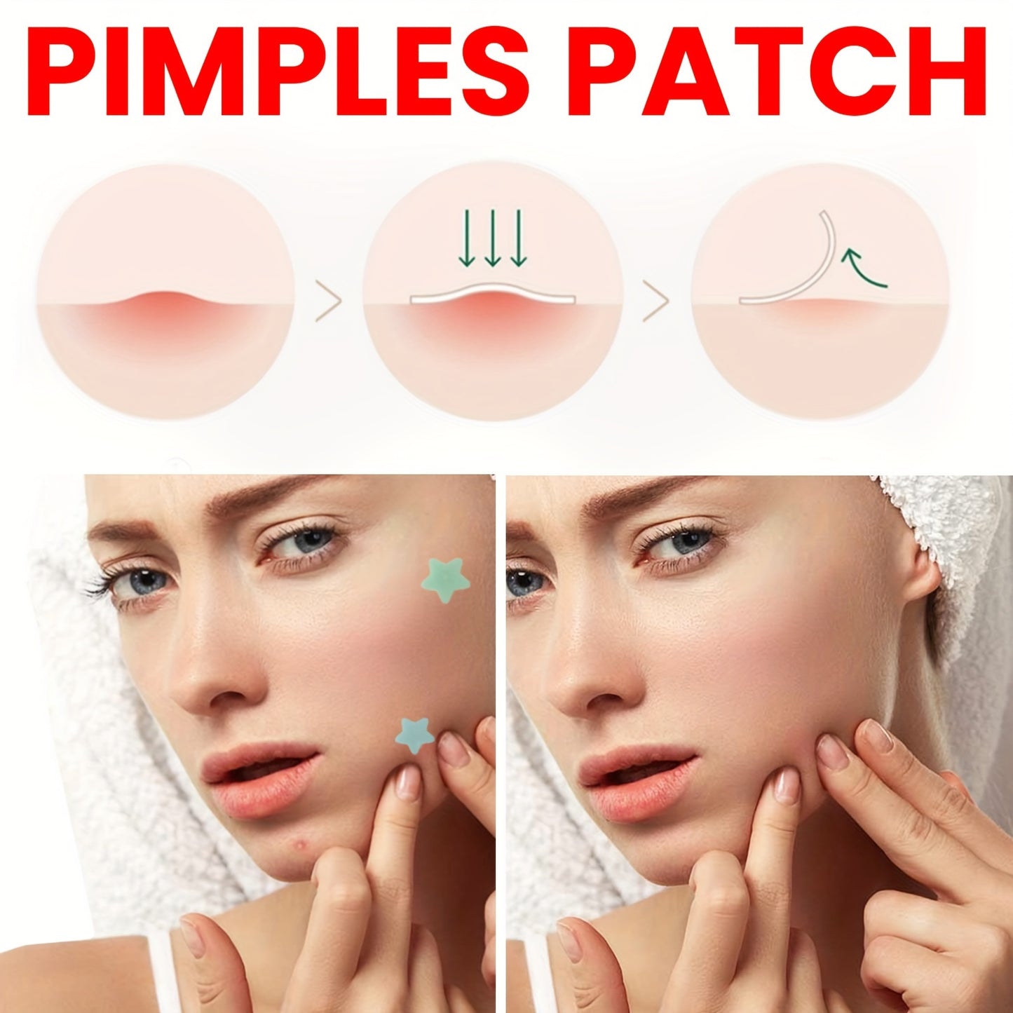 Star Pimple Patches