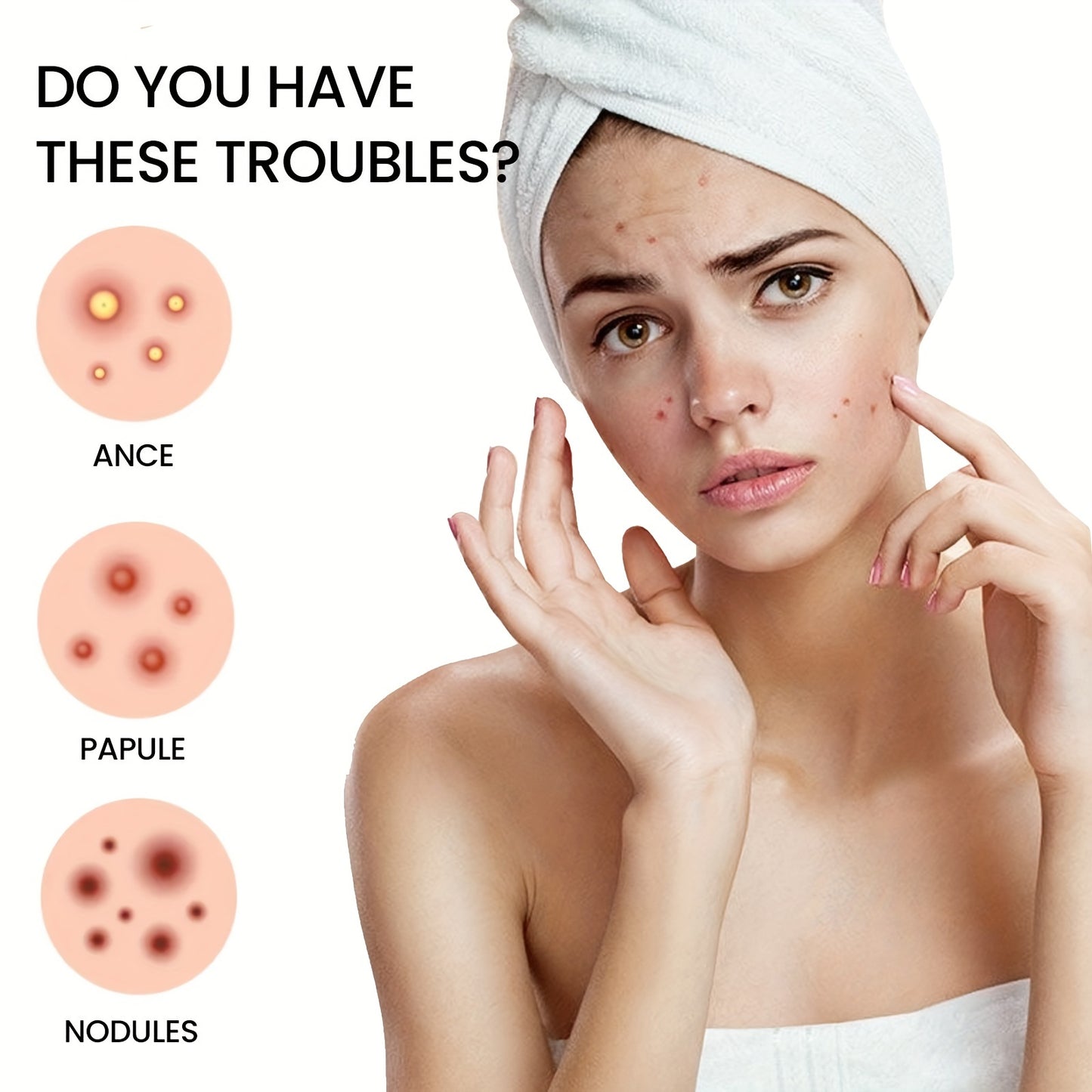 Star Pimple Patches